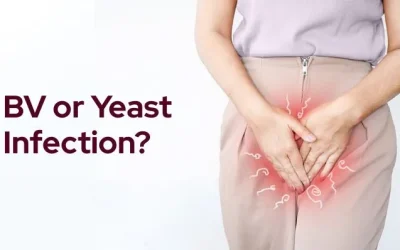 Bacterial Vaginosis vs. Yeast Infection