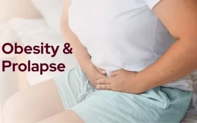Link Between Obesity and Pelvic Organ Prolapse