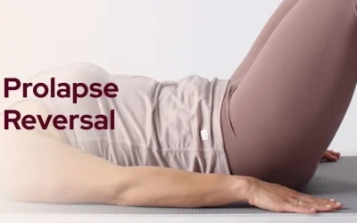 Can Pelvic Organ Prolapse Be Reversed?