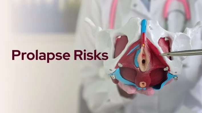 Prolapse Risks