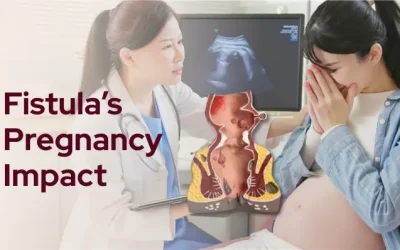 Can a Fistula Affect Your Pregnancy Journey?