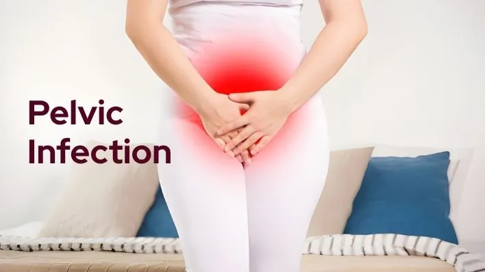 Pelvic Infection