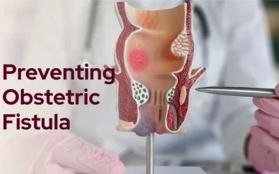A Doctor’s Guide to Preventing Obstetric Fistula