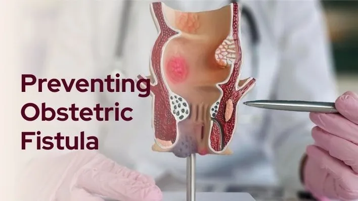 Preventing Obstetric Fistula