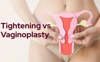 Difference between Vaginal Tightening and Vaginoplasty