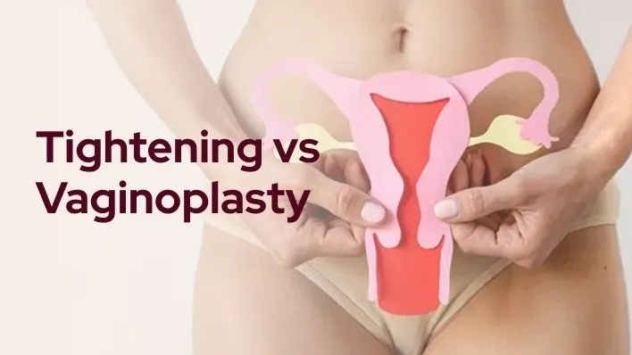 Tightening vs Vaginoplasty