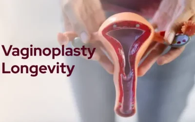 How Long Does a Vaginoplasty Last?