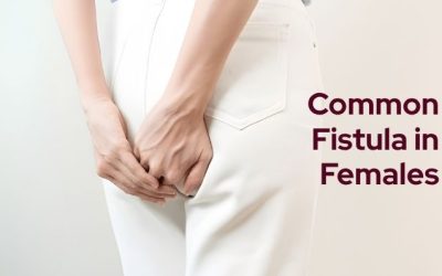 What Is the Most Common Fistula in Females?