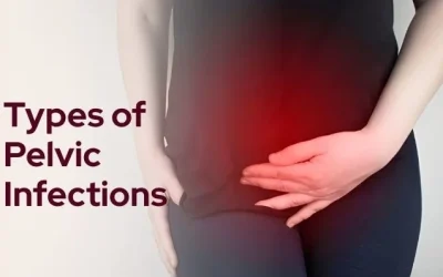 Types of pelvic infections