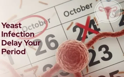 Can a Yeast Infection Delay Your Period?