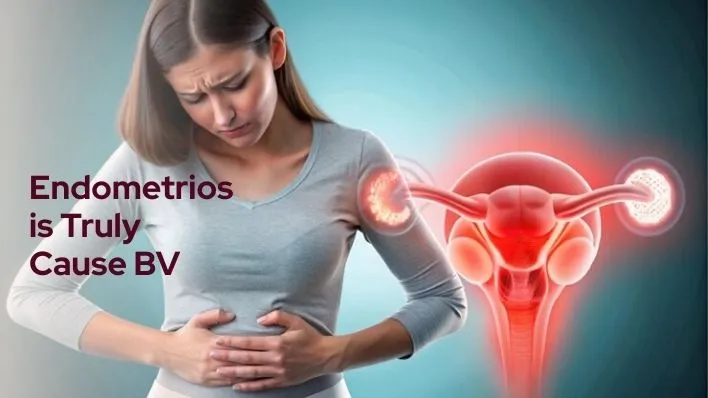 Endometriosis Truly Cause Bacterial Vaginosis