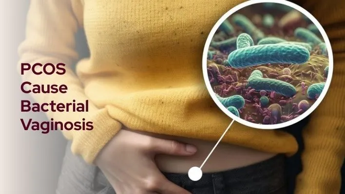 PCOS Cause Bacterial Vaginosis