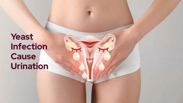 Yeast Infection Cause Frequent Urination