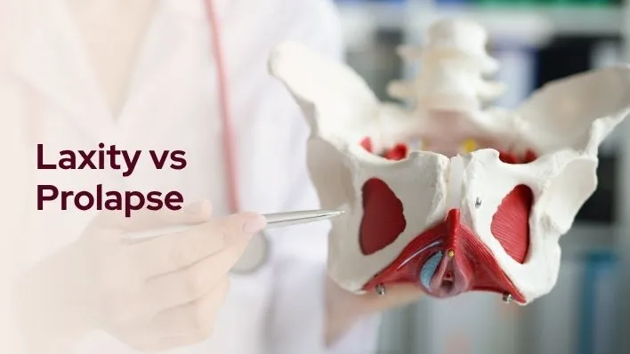 Laxity vs Prolapse