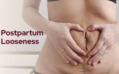 Is Vaginal Looseness After Delivery Permanent or Temporary?