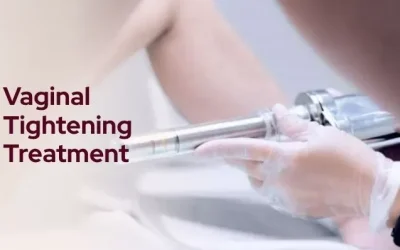 Vaginal Tightening Treatment: Causes, Symptoms, and the Best Solutions
