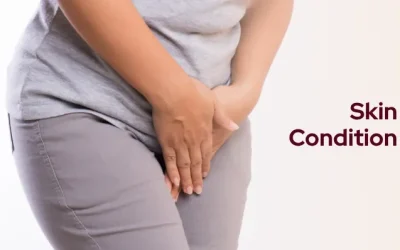 Can Vaginal Itching Without Discharge Really Be a Skin Condition?